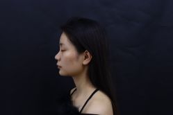 体验后-科佳医疗美容·轻医美