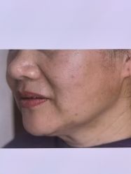 -Yestar 嘉兴艺星医疗美容医院