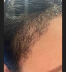 -雍禾植发全国连锁