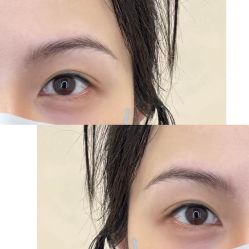 -杨益美学·野生眉半永久纹眉发际线