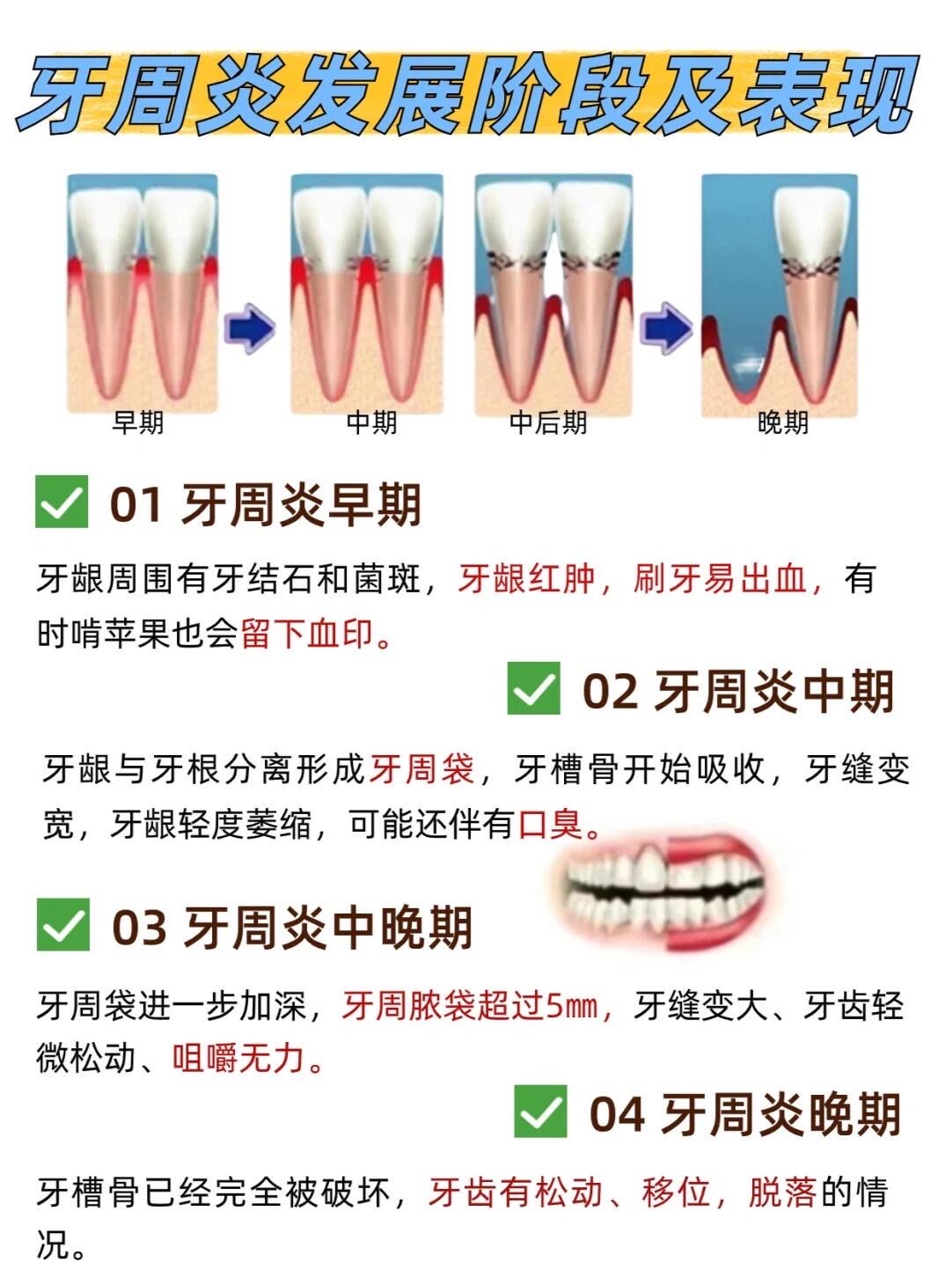 牙龈炎图片大全图解图片