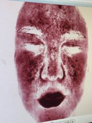 点击看大图 -苏亚医美·高端注射明星整形机构