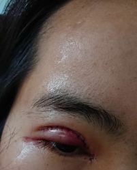 体验后-重庆军美医疗美容医院