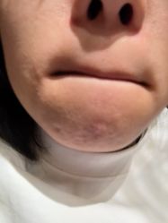 -嘉和医学脱毛中心