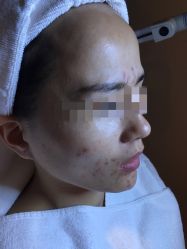 -皇族养心堂·净痘·修敏·御颜
