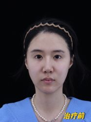 -丰联丽格医疗美容·联合丽格眼整形中心