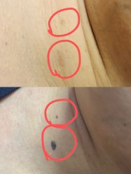 -智丽佳人祛斑祛痘美容美体