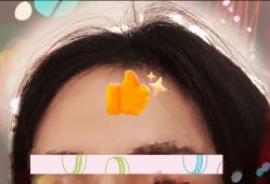 -大麦微针植发全国连锁