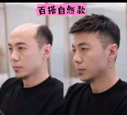 -唐风采假发补发定制