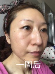 -天津伊美尔医疗整形美容专科医院