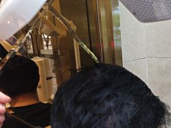 -碧莲盛·不剃发植发