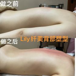 点击看大图 -Lily纤美·科技减脂中心