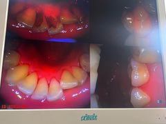 -圣贝口腔(海淀店)