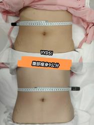 -Lily纤美·科技减脂中心