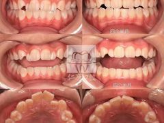 -Dr.Z dental仁康种植矫正中心