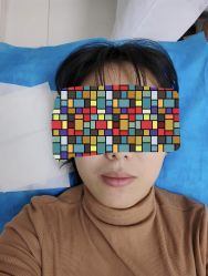 体验后-CMS西美斯·美式医疗美容
