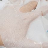 尽管是脸上有痘痘或者被太阳晒过