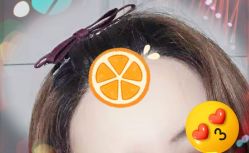 -大麦微针植发全国连锁