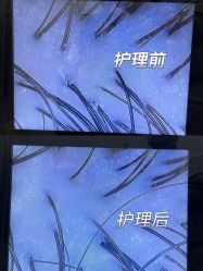 -岳灵生发养发馆