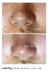 光SPA皮肤深层清洁水氧-光SPA科技美肤