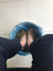 点击看大图 -德哥灰指甲脚气甲沟炎跖疣护理