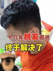 -雍禾植发