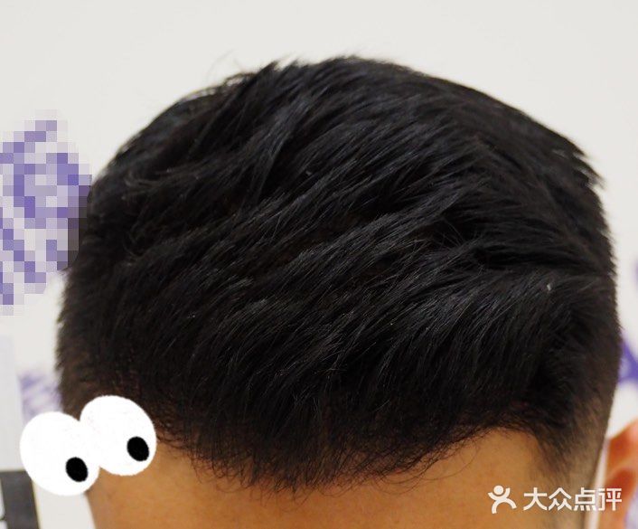 大麦微针植发全国连锁(长沙分院)图片