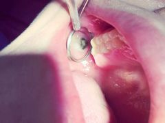 -泰康拜博口腔(世博园乐尔店)