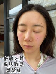 -厦门美莱整形美容医院