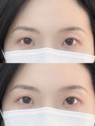 -Doris多里斯半永久纹眉·SMP纹发·发际线