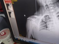 -兴芮温泉度假区