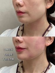 -素美医疗美容·西南眼鼻整形·修复基地