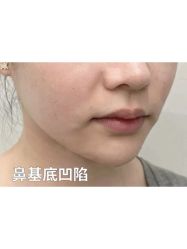 体验前-杭州米兰柏羽医疗美容医院