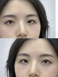 -Doris多里斯半永久纹眉·SMP纹发·发际线