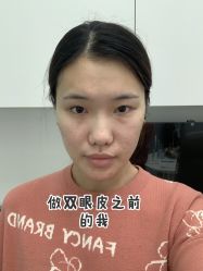 体验前-Dr.U博士医疗美容医院