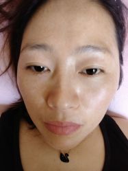 体验后-上海锦妍医疗美容门诊部