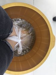 -派恩宜灰指甲鸡眼嵌甲手足癣