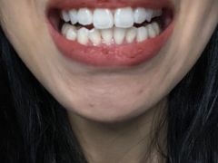 -常熟玉蕙口腔医院