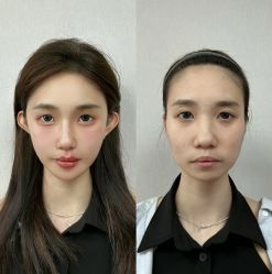 -宁波美莱整形美容