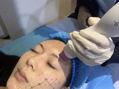 -蒲黄榆(地铁站)