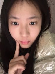 -成都西区医院整形美容