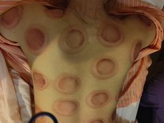 -艺林盲人按摩院(长寿店)