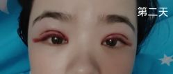 -广州美莱医疗美容医院