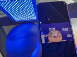 -碧莲盛·不剃发植发