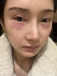 -杭州奥拉克医疗美容门诊部