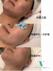 -VE专注问题肌·赛诺龙&科学美肤中心