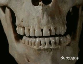 晚上睡觉磨牙？什么原因呢？