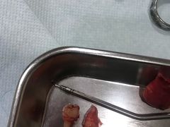 -爱齿尔口腔美学种植中心(永清院)