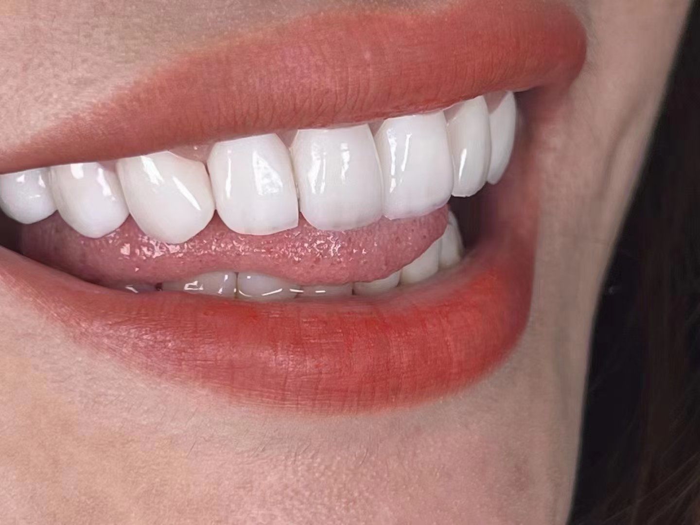 明眸皓齿 唇红齿白 美女帅哥标配
