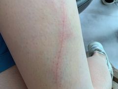 -合肥滨湖国家森林公园